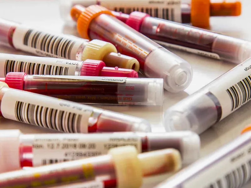 Blood Collection