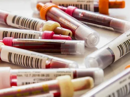 Blood Collection